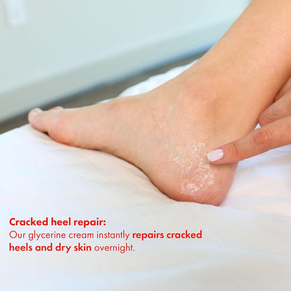 ELMORE Daily Moisturizing Cream for Dry Skin, Advanced Dry Skin Cream Moisturizer for Body, Hands and Feet, Chamomile Infused 42% Pure Glycerine Cream - Non Greasy, Fragrance Free Thick Moisturizer