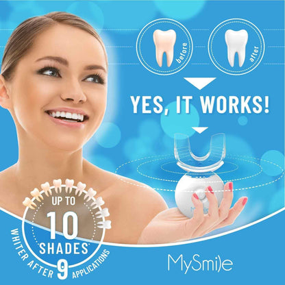 MySmile Teeth Whitening Kit with LED Light | 10-Min Fast Non-Sensitive Whitening | 3 Carbamide Peroxide Gels | Removes Coffee, Wine, Smoking & Food Stains