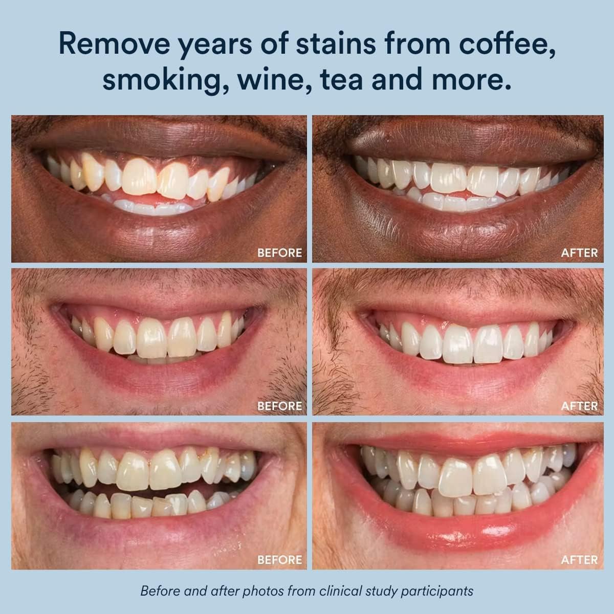 Auraglow Whitening Toothpaste Booster | 9% Hydrogen Peroxide Teeth Whitening Gel | Add to Any Toothpaste | 350+ Treatments | 6-Month Supply (2.6 oz)