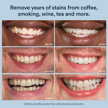 Auraglow Whitening Toothpaste Booster | 9% Hydrogen Peroxide Teeth Whitening Gel | Add to Any Toothpaste | 350+ Treatments | 6-Month Supply (2.6 oz)