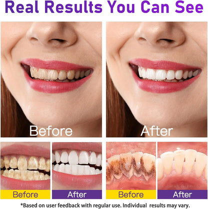 Teeth Whitening Powder – Enamel-Safe, No Sensitivity, Removes Coffee, Tea, Food & Tobacco Stains