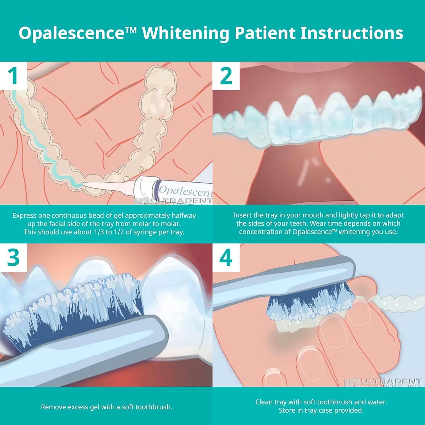 Opalescence 35% CP Mint Teeth Whitening Gel | Refill Kit with 4 Syringes | Professional Carbamide Peroxide Whitening by Ultradent