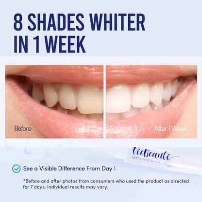 VieBeauti Teeth Whitening Kit for Sensitive Teeth | LED Light | 35% Carbamide Peroxide Gel | Remineralizing Gel | Fast Mint Whitening
