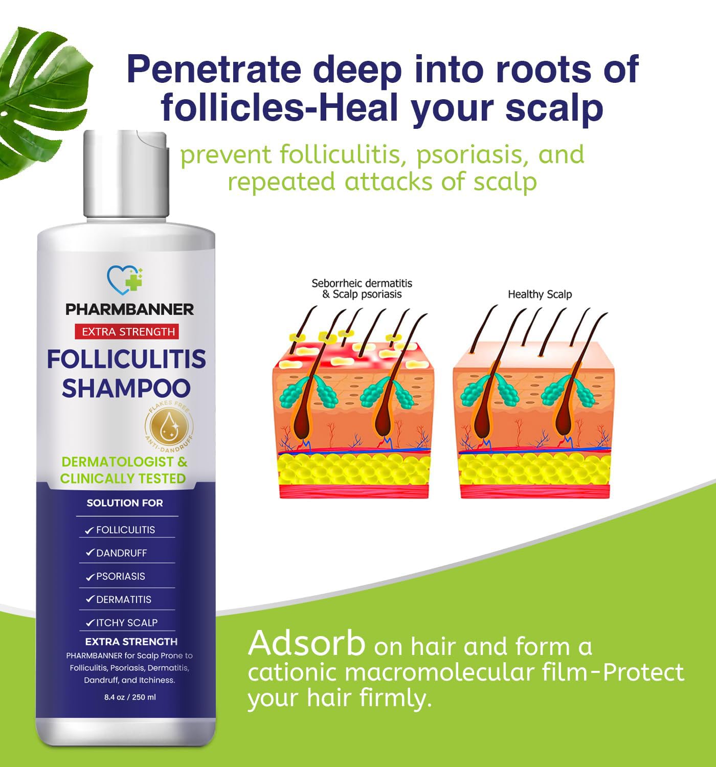 Anti-Fungal Shampoo for Folliculitis, Seborrheic Dermatitis & Scalp Psoriasis | Relieves Itchy, Dry Scalp