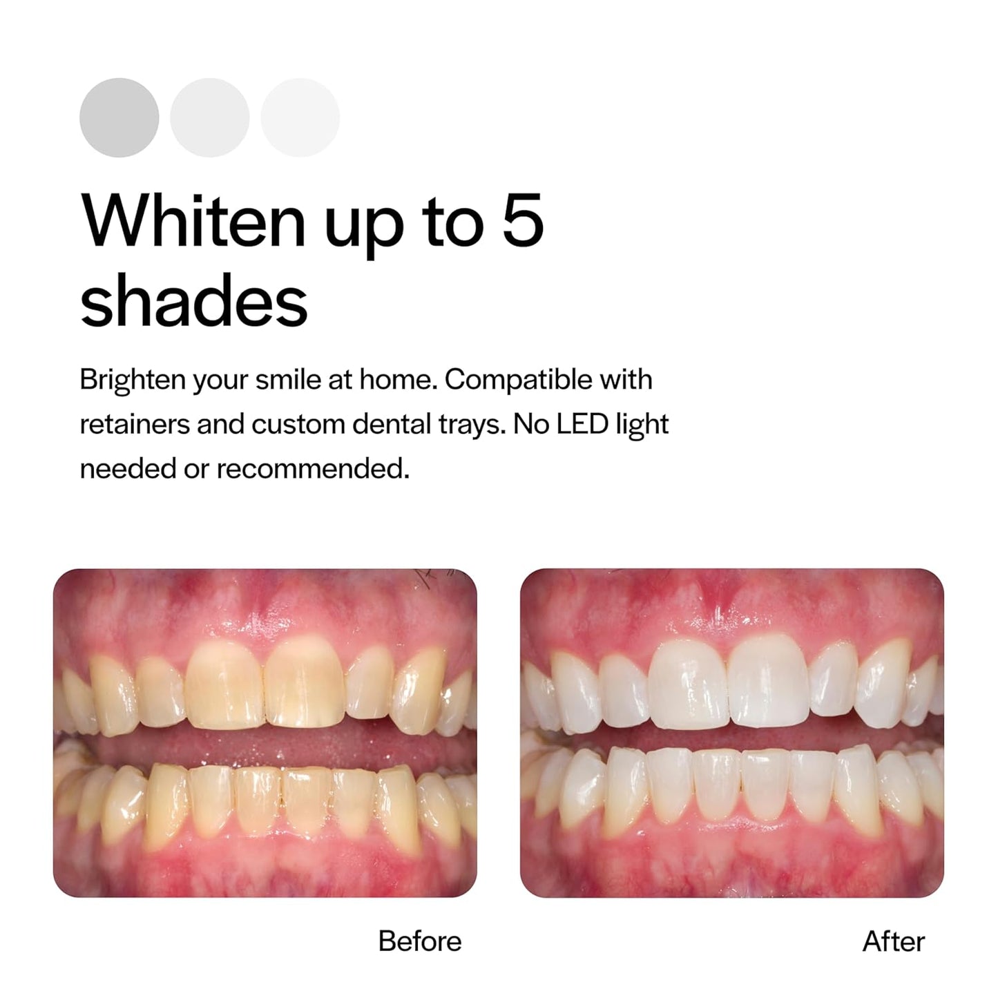 Opalescence 35% CP Mint Teeth Whitening Gel | Refill Kit with 4 Syringes | Professional Carbamide Peroxide Whitening by Ultradent