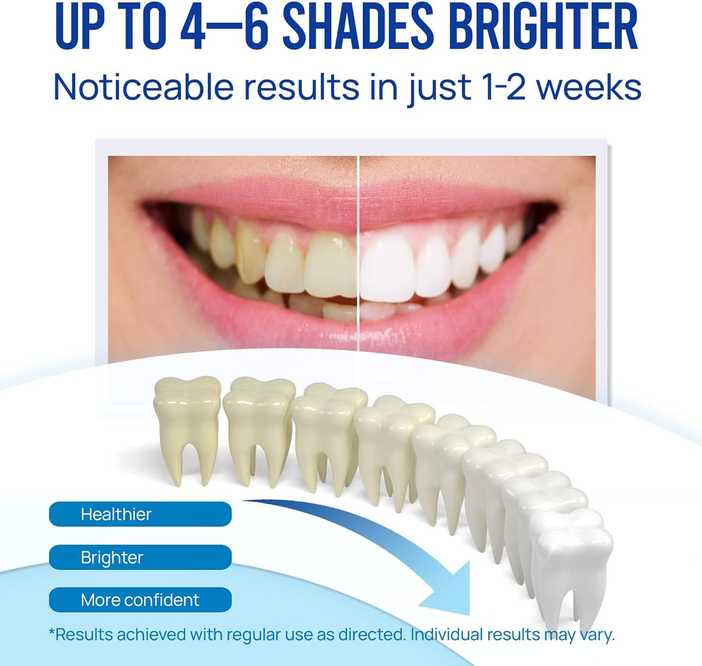 Teeth Whitening Pen Gel Kit | 35% Carbamide Peroxide | No-Sensitivity Formula with Remineralizing Pen | Mint Flavor | 5-Pack