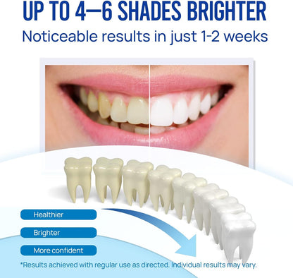 Teeth Whitening Pen Gel Kit | 35% Carbamide Peroxide | No-Sensitivity Formula with Remineralizing Pen | Mint Flavor | 5-Pack