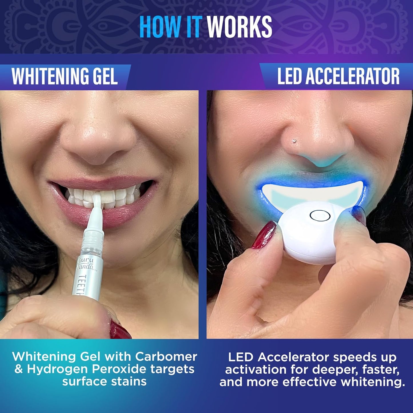 GuruNanda Professional Teeth Whitening Kit | Wireless LED Light & Whitening Pen | Removes Coffee, Food & Soda Stains | 40 Treatments