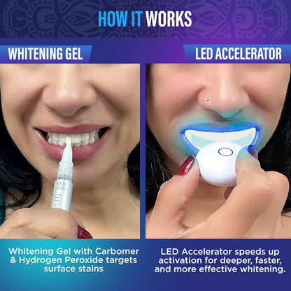 GuruNanda Professional Teeth Whitening Kit | Wireless LED Light & Whitening Pen | Removes Coffee, Food & Soda Stains | 40 Treatments